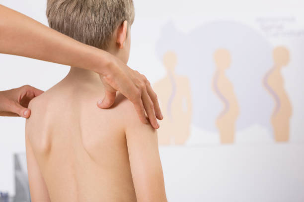 fisioterapista corregge la postura dei bambini - scoliosis foto e immagini stock