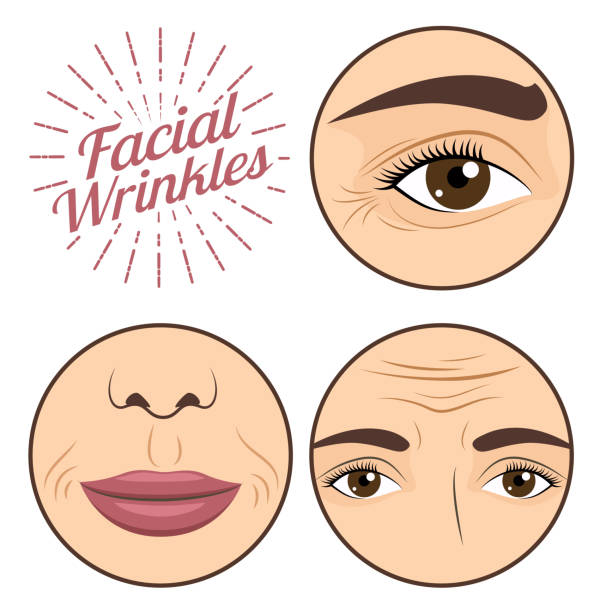 Young woman facial wrinkles troubles for anti wrinkle process cream vector illustration Young woman facial wrinkles troubles for anti wrinkle process cream vector illustration. Trouble femal face, problem wrinkle defection stock illustrations