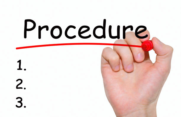 istock Hand writing inscription Procedure with marker, concept 664015596