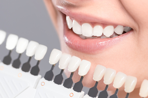 Hermosa sonrisa y dientes blancos de una mujer joven. photo