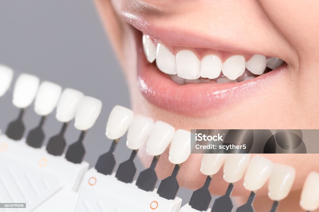 Beau sourire et des dents blanches d’une jeune femme. - Photo de Dents libre de droits