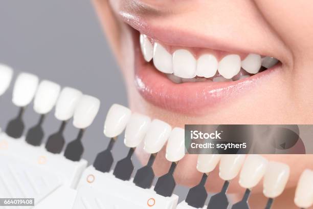 Beautiful Smile And White Teeth Of A Young Woman Stock Photo - Download Image Now - Teeth, Tooth Whitening, White Color