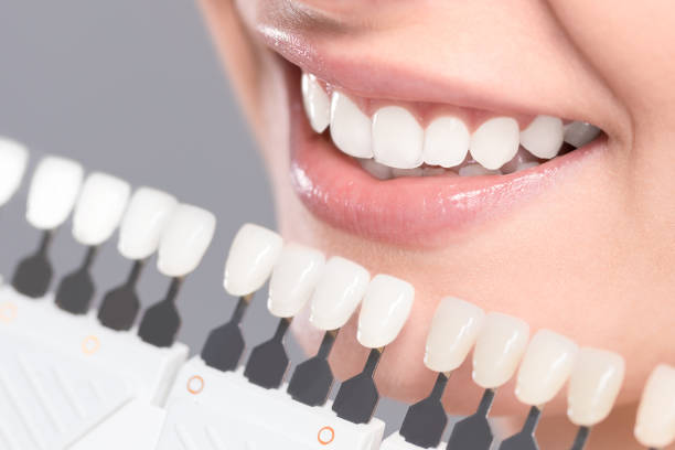 красивая улыбка и белые зубы молодой женщины. - human teeth whitening dentist smiling стоковые фото и изображения