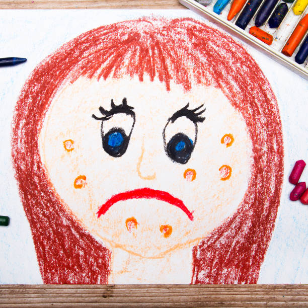 istock colorful drawing: sad young woman with acne 664218132