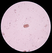 eier-von-parasiten-in-stuhl-untersuchung-mensch.jpg?b=1&s=170x170&k=20&c=jXCvqf3Ca7CNWlbAQTaJjxpVuCWJytkakLfuRfqaCZE=