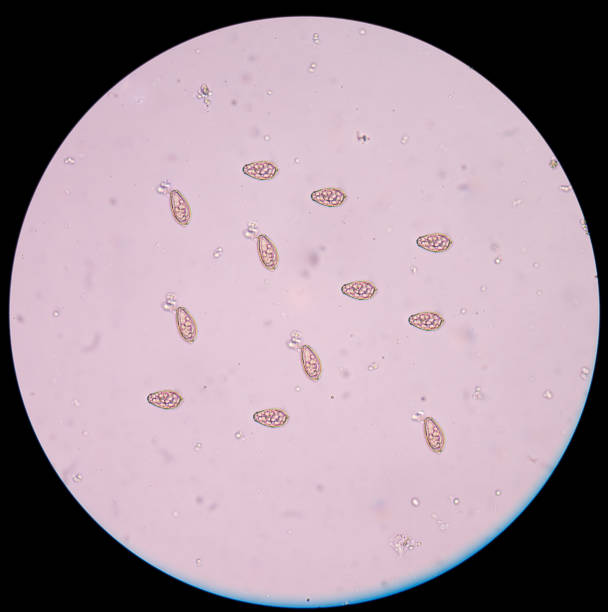 istock Eggs of parasite in stool exam human 664297798