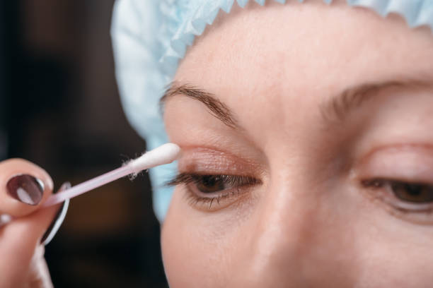 istock Blepharoplasty of the upper eyelid. 664477516