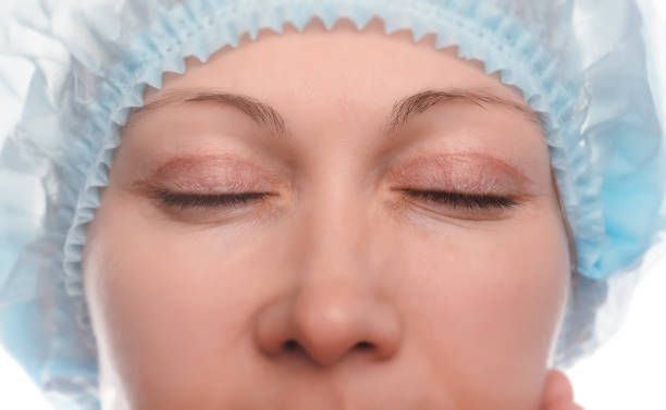 blepharoplasty of the upper eyelid. - upper arm fotos imagens e fotografias de stock