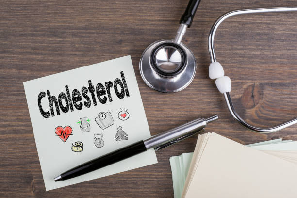 Cholesterol, Workplace of a doctor. Stethoscope on wooden desk background stock photo