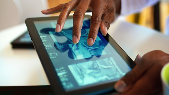 Closeup of doctor looking at xrays and CAT scan on digital tablet.