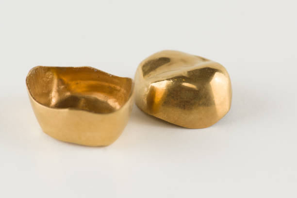 istock steel crowns with yellow coated 665545000
