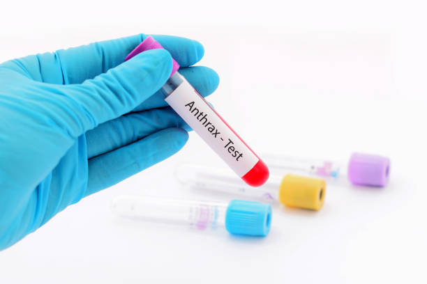 Anthrax Lab Testing 790+ Anthrax Bacteria Stock Photos, Pictures & Royalty-Free Images - iStock