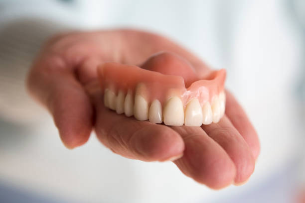 closeup of womans hand holding a teeth denture - dental implant dental hygiene dentures prosthetic equipment imagens e fotografias de stock