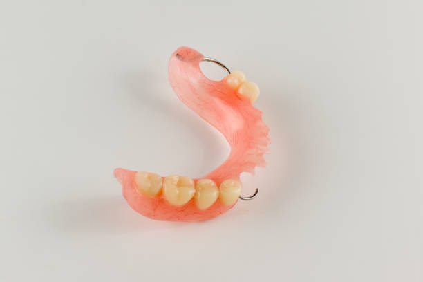istock acrylic denture with metal clasps 666129400