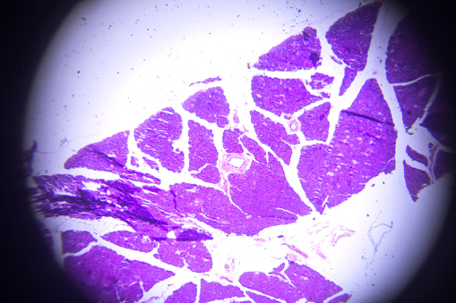 sección de páncreas en microscopio photo