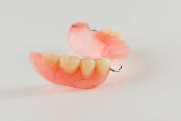 istock acrylic denture with metal clasps 666387386
