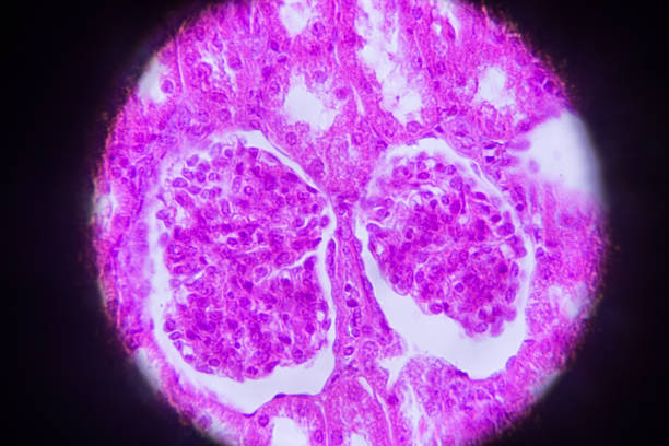 sección de riñón en microscopia - kidney cancer fotografías e imágenes de stock