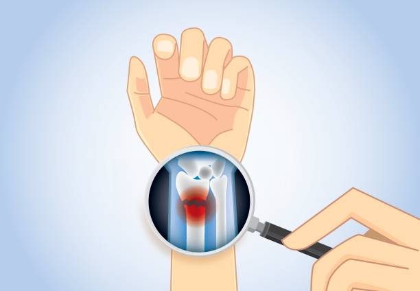 глядя внутренний перелом запястья с magnifier. - physical checkup stock illustrations