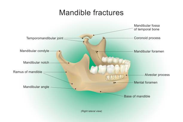 Mandible fractures. vector anatomy human. vector art illustration