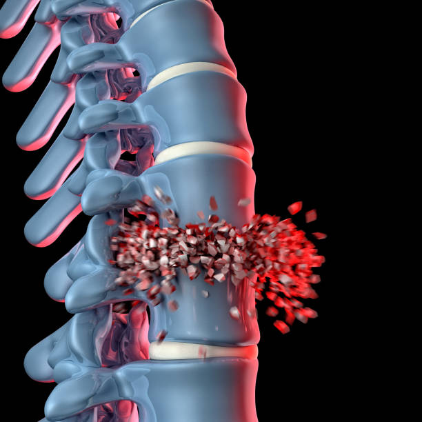 ludzka kość kręgowa 3d - human spine human vertebra disk spinal zdjęcia i obrazy z banku zdjęć