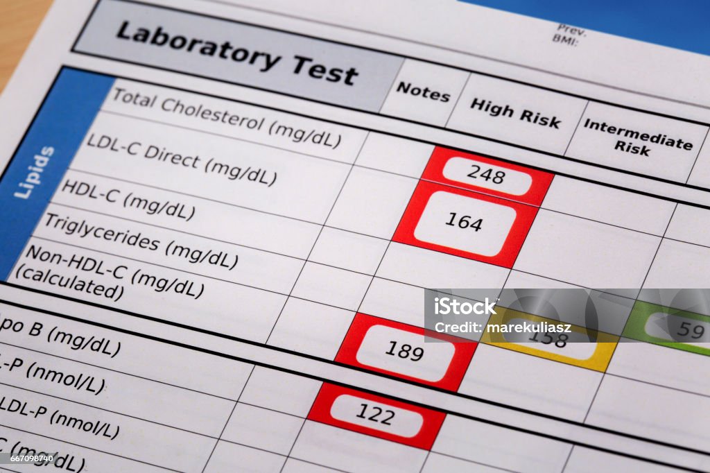 high risk cholesterol test results high risk cholesterol  - a detail of blood laboratory screening results with focus on lipids panel Abstract Stock Photo
