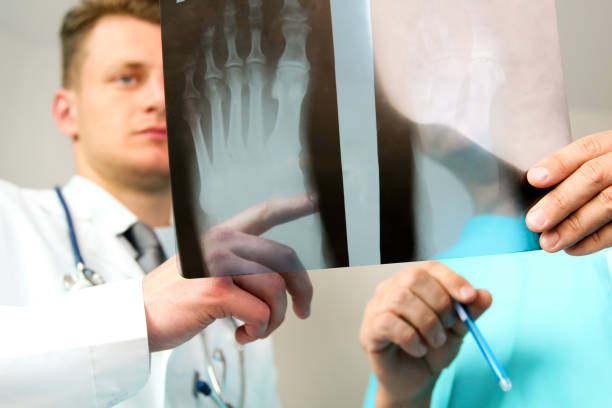 conceito de cuidados de saúde, medicina e radiologia - médicos do sexo masculino a olhar para o raio-x do pé - radiogram photographic image - fotografias e filmes do acervo