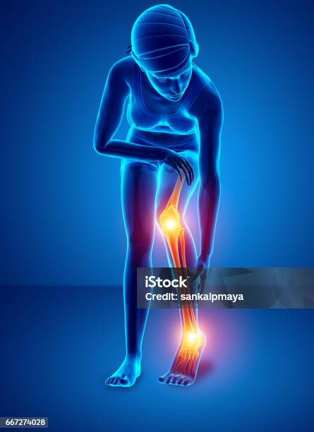 Lower Leg Problems Pain In Leg Stock Illustration - Download Image Now - Accuracy ...