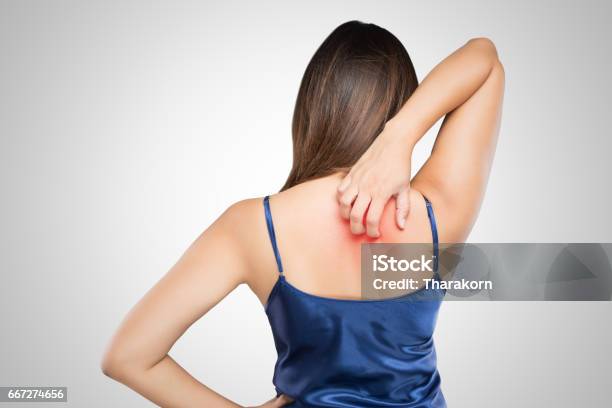 Woman Scratching Her Itchy Back With Allergy Rash Concept With Healthcare And Medicine Stock Photo - Download Image Now