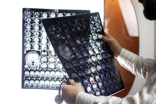 istock Doctor holding a picture of a brain MRI workflow 667353302
