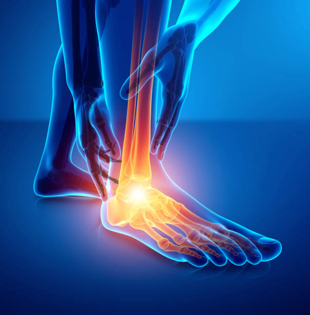 Male foot with ankle pain vector art illustration