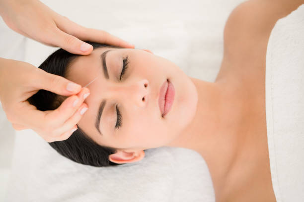 istock Woman in an acupuncture therapy 667502428
