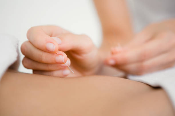 istock Woman holding a needle in an acupuncture therapy 667502528