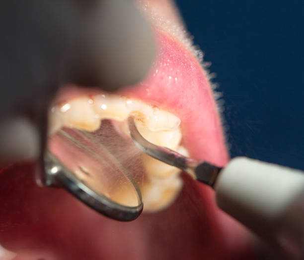 istock dental treatment in dentistry 667661528