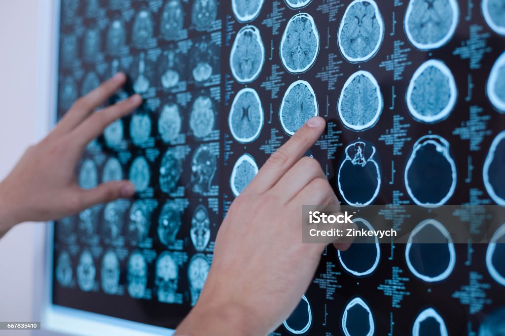 Imágenes de rayos x del cerebro humano que ponen en la pizarra - Foto de stock de Inteligencia libre de derechos