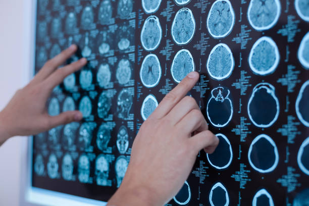 人間の脳のレントゲン画像をホワイト ボードに置く - medical scan 写真 ストックフォトと画像