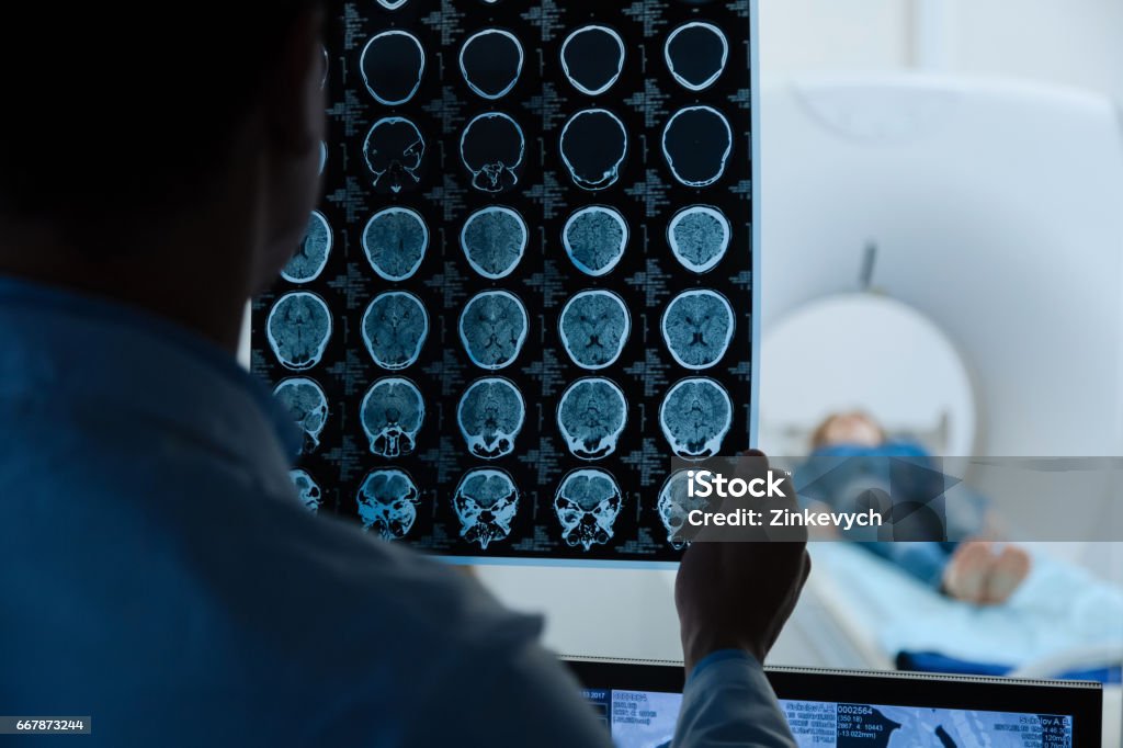 MRI scan images being examined by a doctor Brain pathology. Close up of MRI scan images being examined by a professional male doctor while doing a medical research Neurosurgery Stock Photo