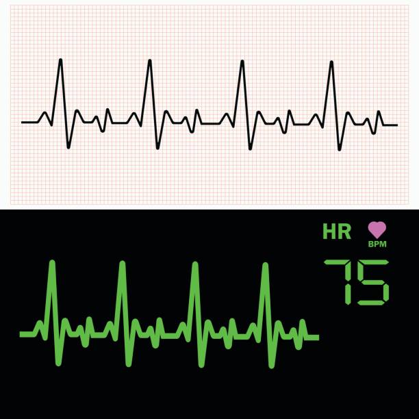 Heart cardiogram waves on graph paper and on monitor. Vector illustration. vector art illustration