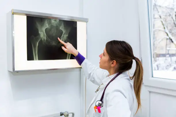 Photo of Pretty young woman doctor watching x-ray image of human pelvis....