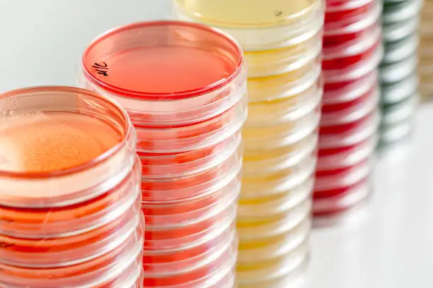 Photo of Red and yellow petri dishes stacks in microbiology lab on the bacteriology laboratory background