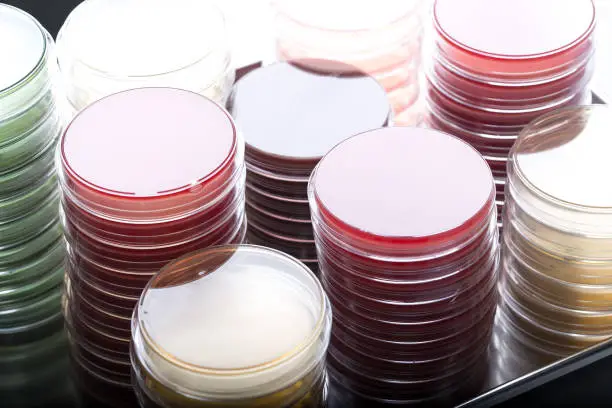 Photo of Red and yellow petri dishes stacks in microbiology lab on the bacteriology laboratory background