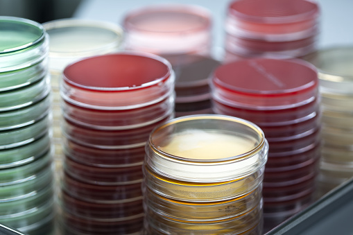 Pilas de rojo y amarillo placas de Petri en el laboratorio de Microbiología en el fondo del laboratorio de bacteriología photo
