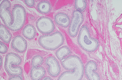 Micrograph showing  spermatozoa, epididymis, ductuli efferentes.