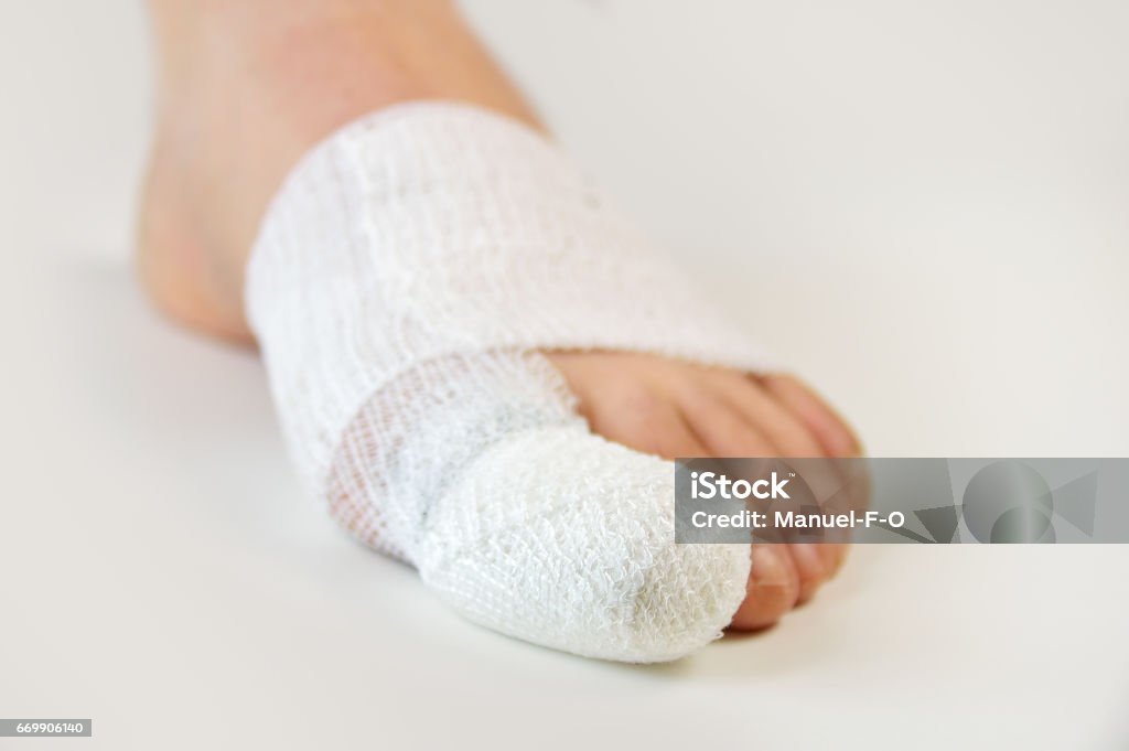 verletzten Fuß mit Bandagen - Lizenzfrei Zeh Stock-Foto