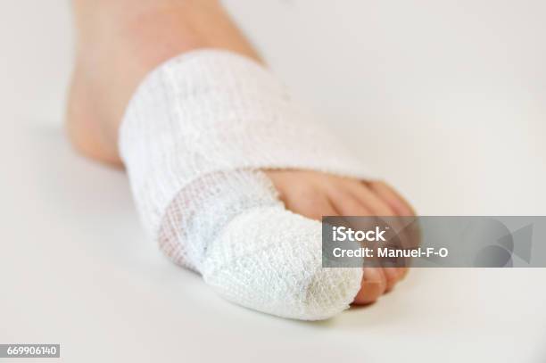 Verletzten Fuß Mit Bandagen Stockfoto und mehr Bilder von Zeh - Zeh, Bandage, Fuß - Anatomiebegriff