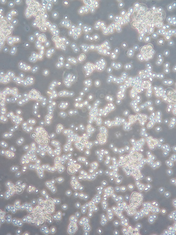 Yeast cells under microscope view