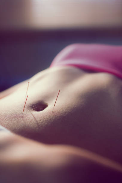istock Young woman getting acupuncture treatment 670238140