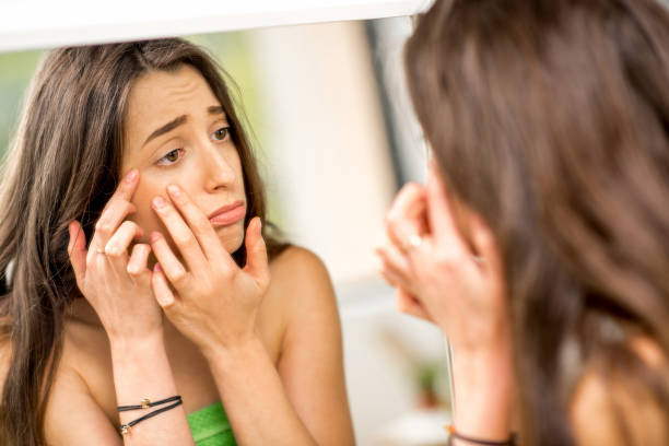istock Woman with acne in the bathroom 670514200