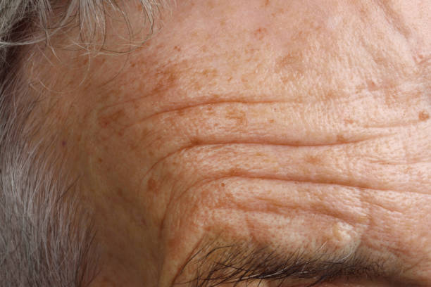 eyebrow of senior woman