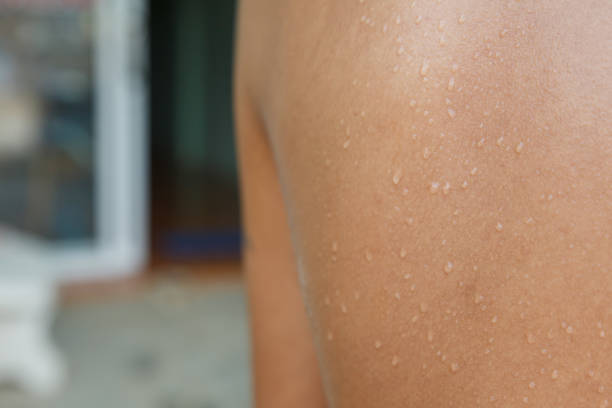 istock Sweat water on Human Skin. 670667808