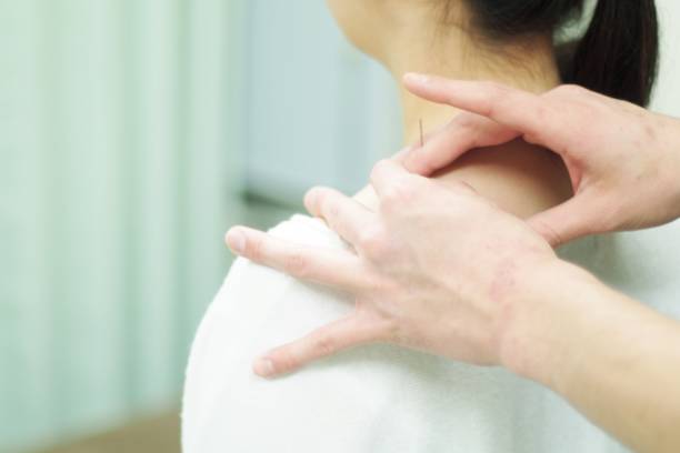 istock Woman receiving acupuncture 670776340